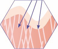 CRISTAL Skin Emission von Radiofrequenzwellen CRISTAL Skin Emission von Radiofrequenzwellen